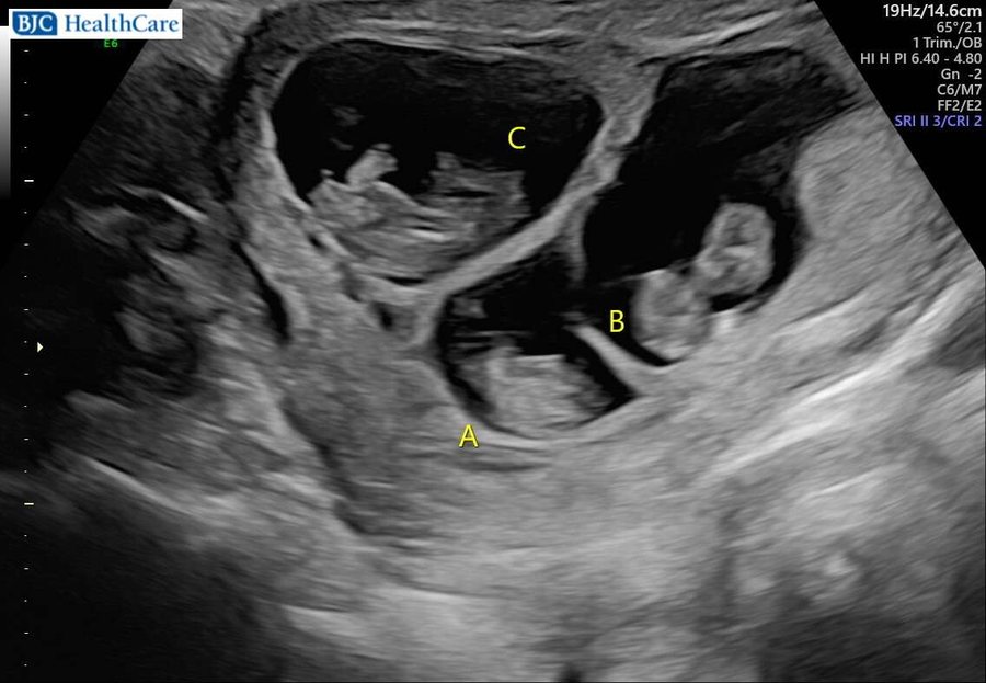 Ultrasound image shared in the October 2026 newsletter